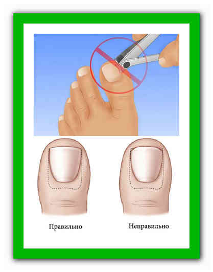 Как правильно подстричь, подрезать ногти на руках и ногах.