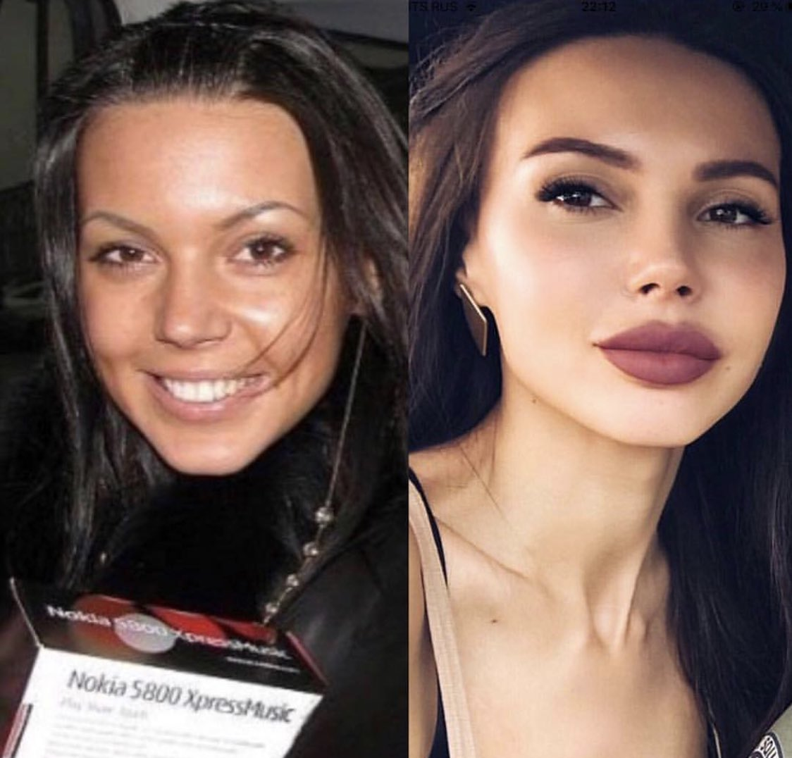 Оксана самойлова до и после пластических операций, фото и видео