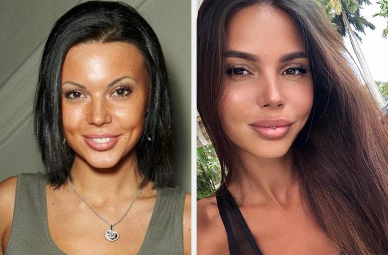 Оксана самойлова до и после пластики - фото и названия процедур звездной жены | maritera.ru