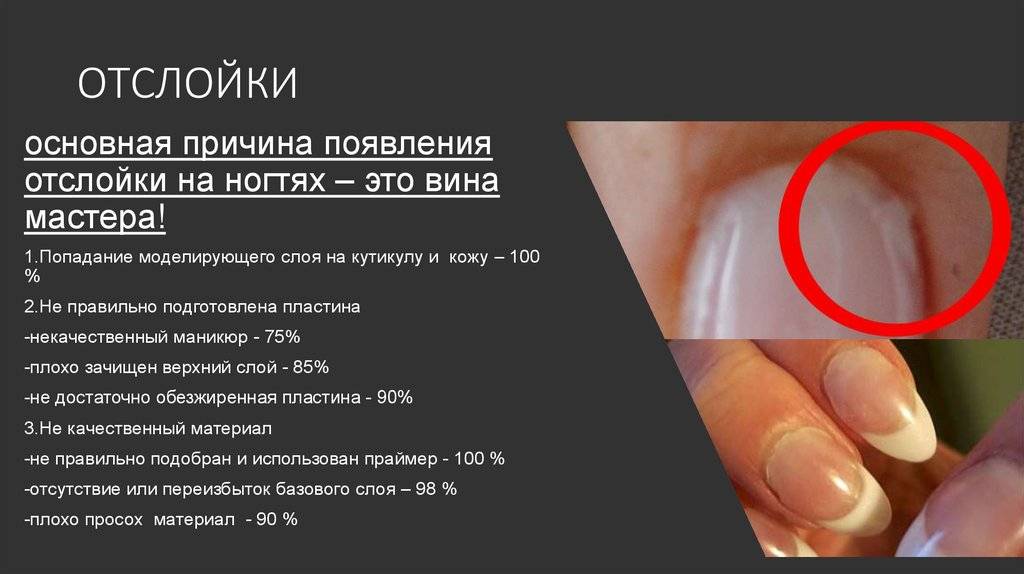 Почему отслаивается гель-лак с кончиков ногтей и скалывается