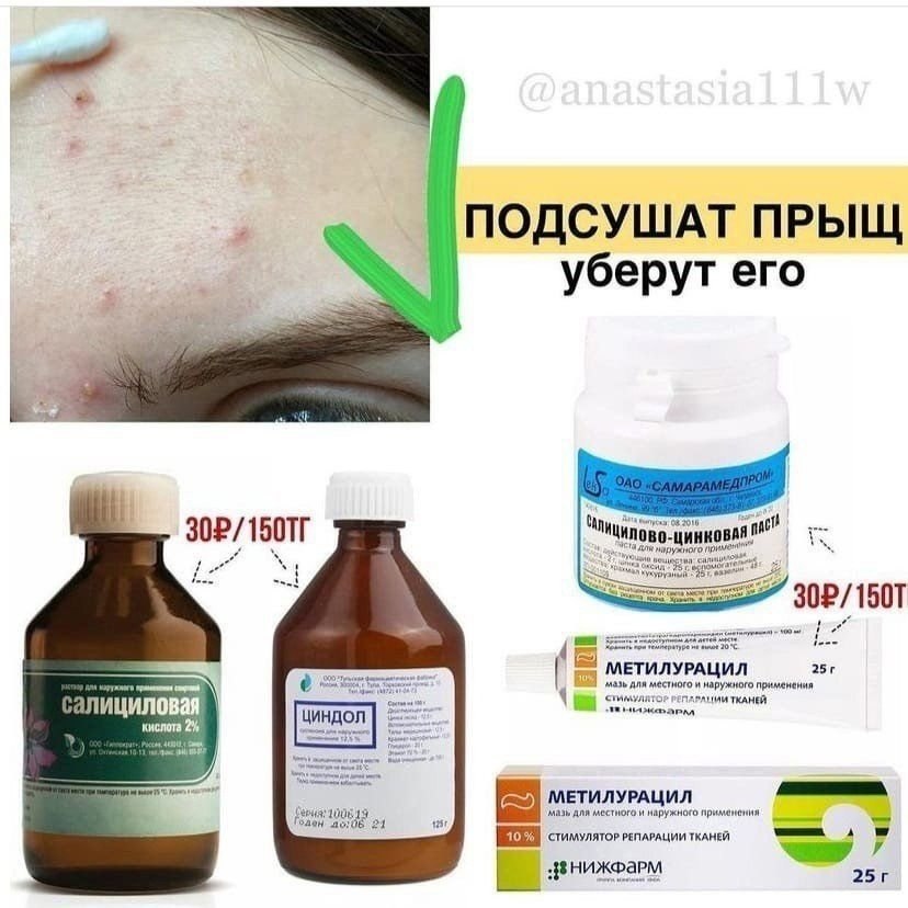 Как избавиться от прыщей на лице в домашних условиях народными средствами быстро и эффективно