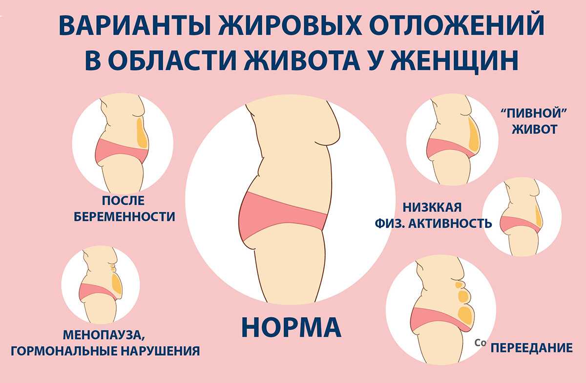 Три главных способа как убрать подкожный жир с живота у мужчин