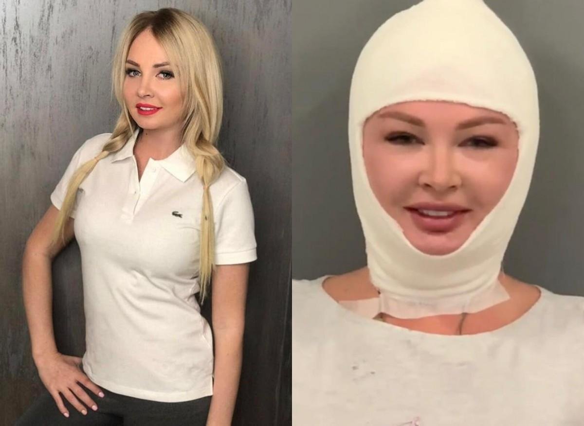 Дарья пынзарь увеличила грудь - фото до и после, видео
