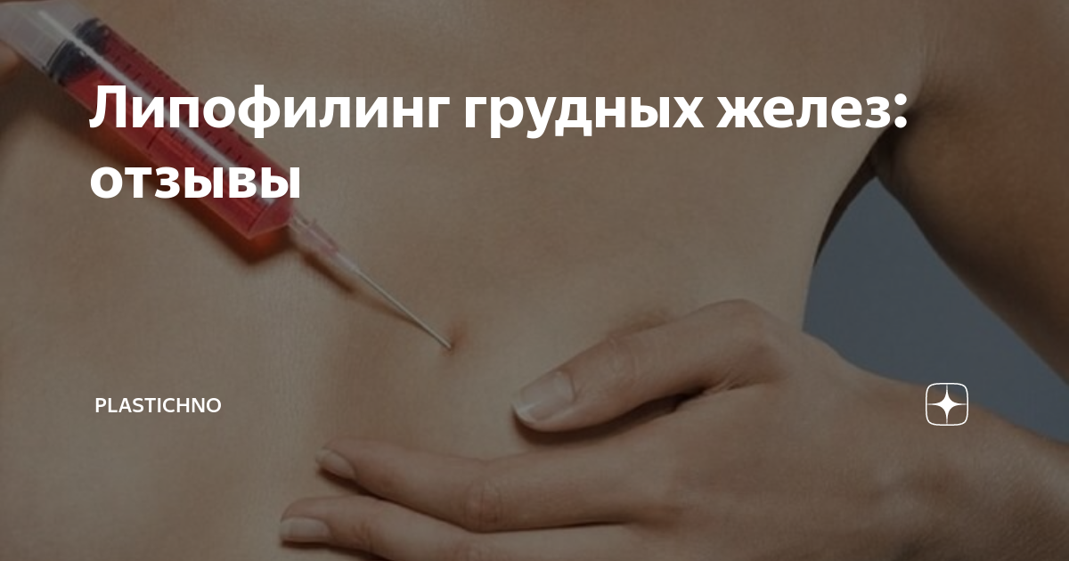 Насколько эффективен липофилинг груди?