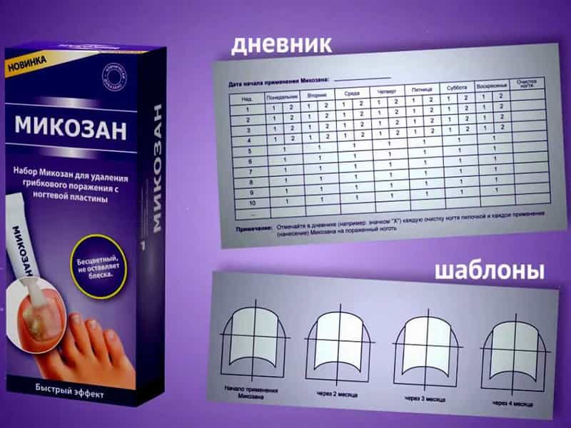 Микозан — эффективное средство против грибка ногтей