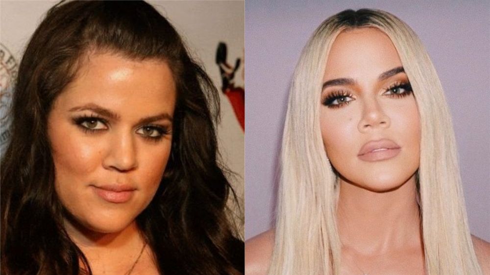 Пластические операции ким кардашьян: фото до и после