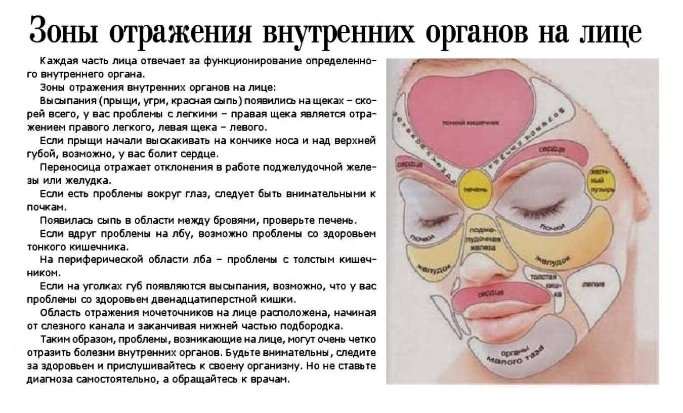 Карты прыщей на лице и их взаимосвязь с заболеваниями человека