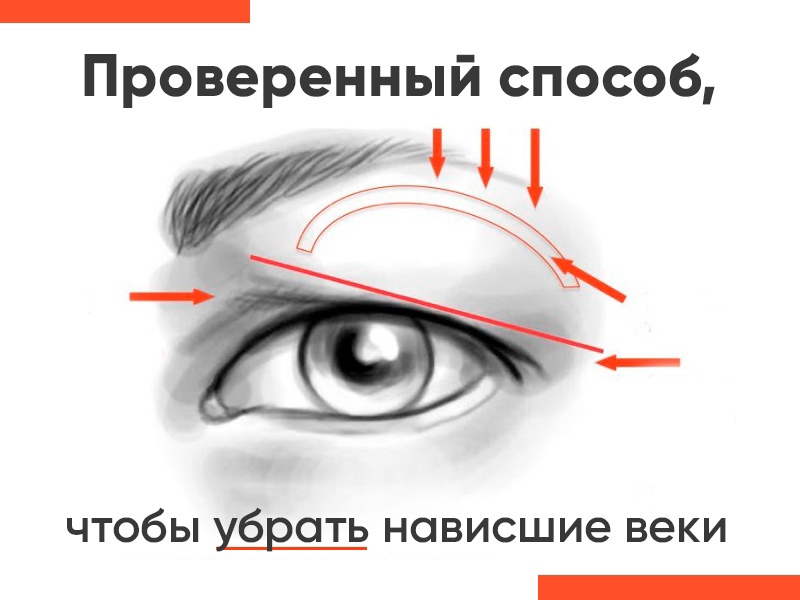 Как подтянуть верхние веки без операции в домашних условиях
