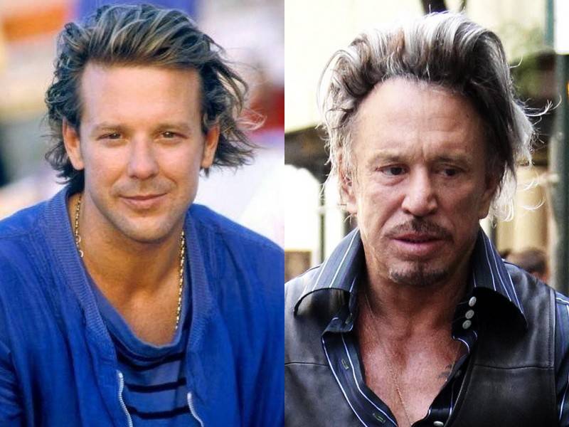 Микки рурк до и после пластических операций и подтяжек кожи