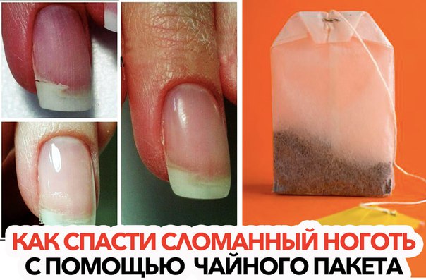 Ноготь сломался что делать