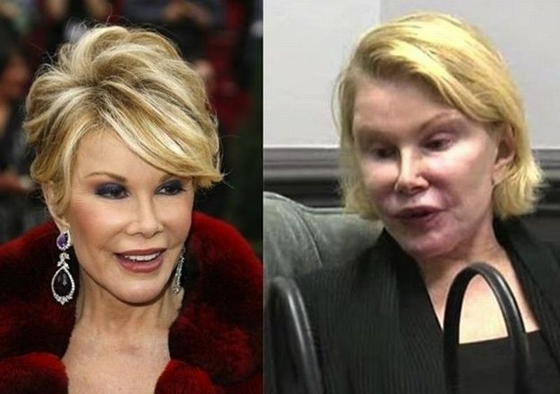 Was joan rivers killed for insulting the obamas?!