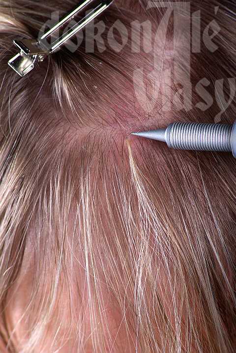 Наращивание волос вашего типа: самые современные методы - voloslekar.ru