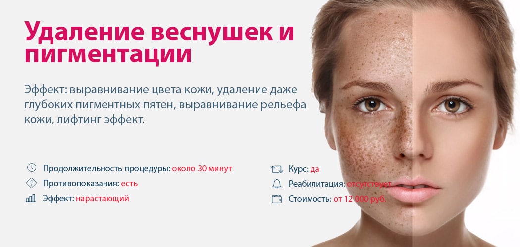 Пигментные пятна на лице: причины возникновения, методы лечения, лучшие средства