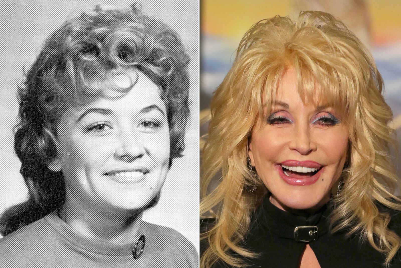 Dolly parton’s plastic surgery transformation: here’s what we know