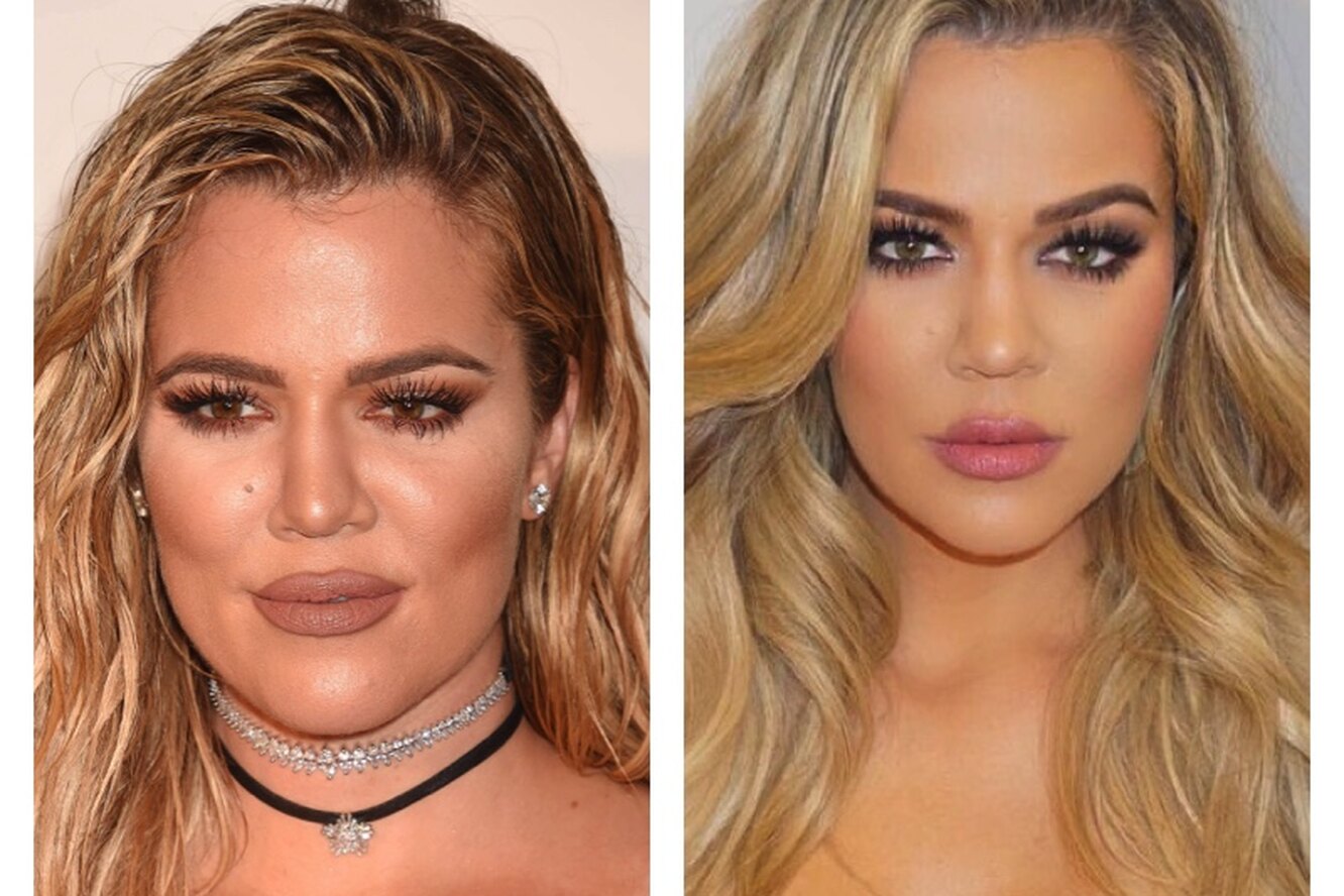 Карьера и личная жизнь хлои кардашян. хлоя кардашьян — фотографии светской дивы после пластических операций на лице и теле планы на будущее