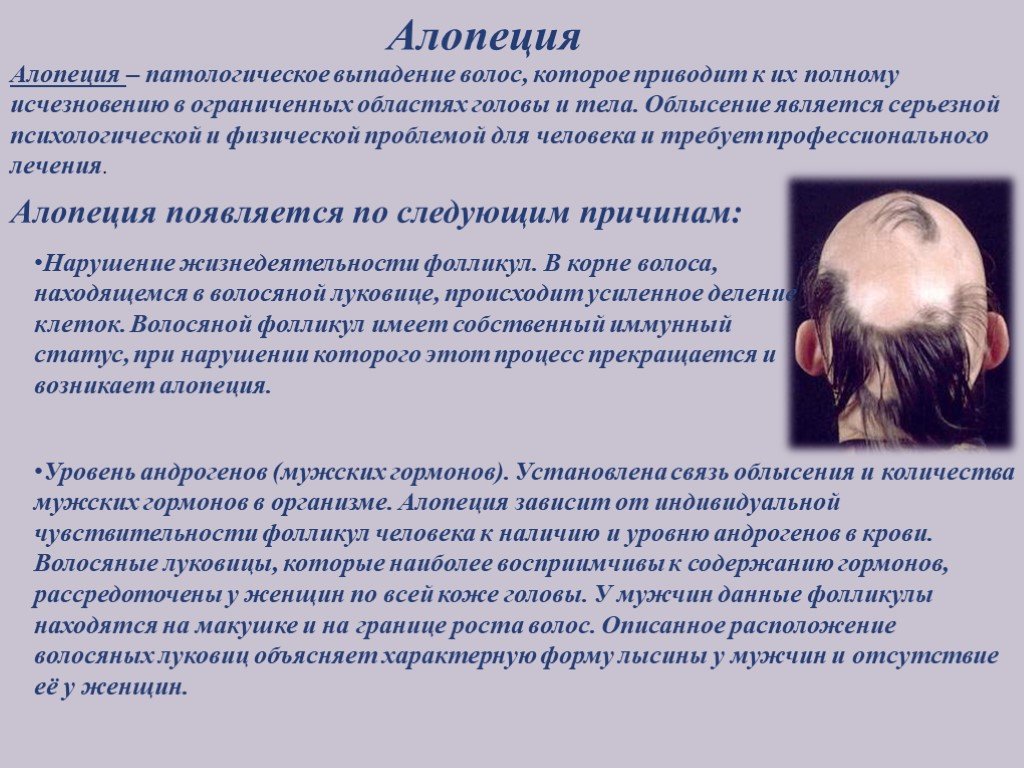 Диффузная алопеция у женщин – причины выпадения волос и лечение
