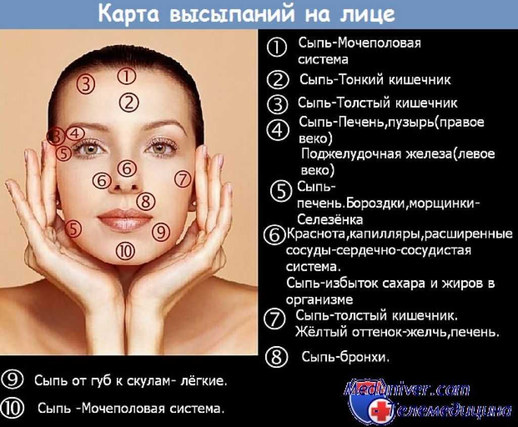 10 топ методов как быстро избавиться от прыща всего за 1 день или ночь