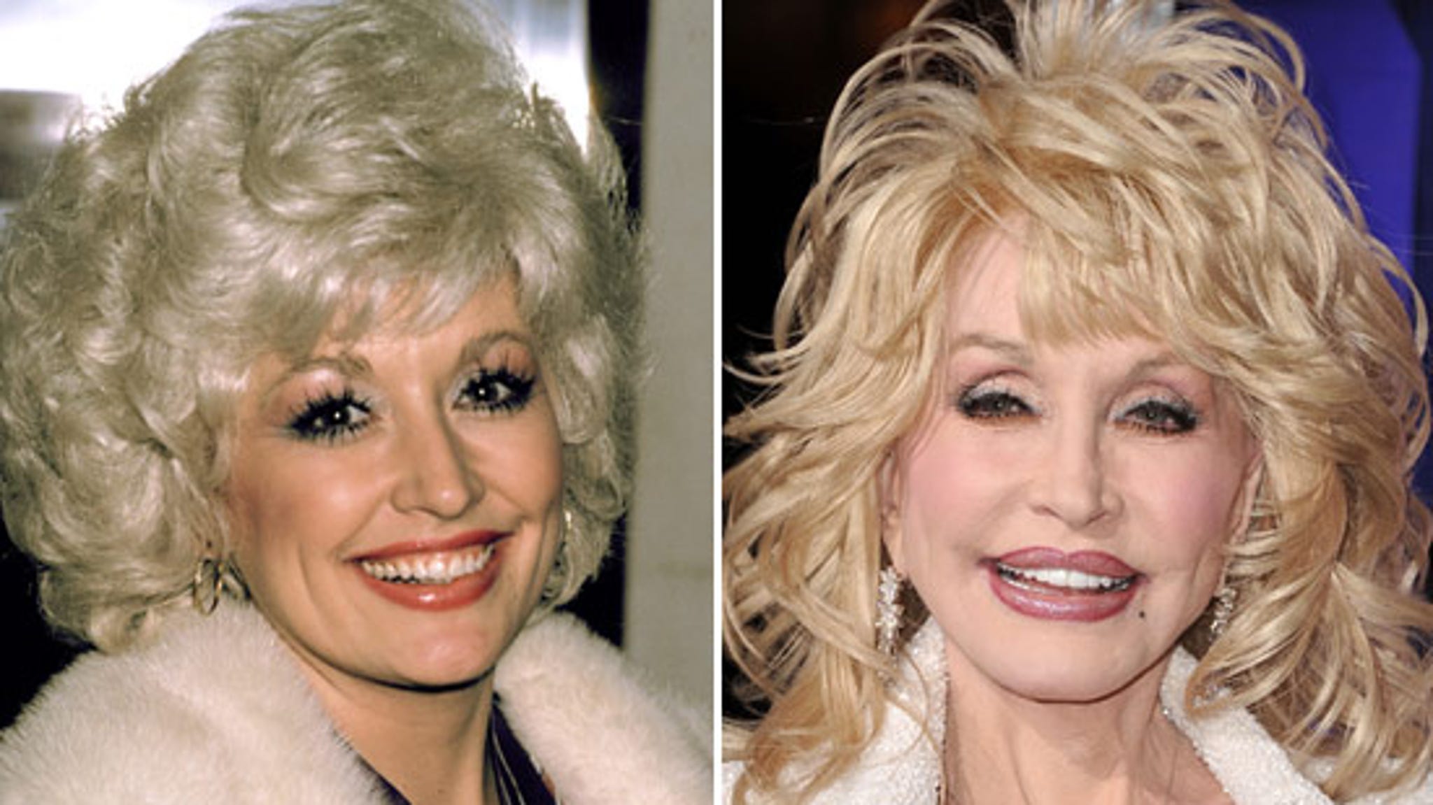 Dolly parton’s plastic surgery transformation: here’s what we know | pinkvilla