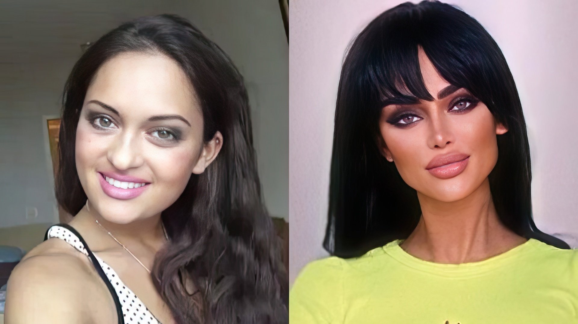 Нита кузьмина до и после пластики