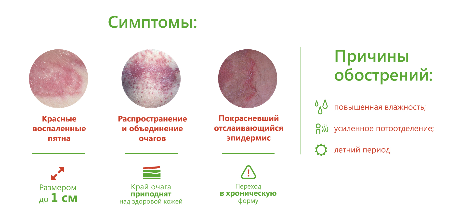 Стрептодермия у детей и взрослых: симптомы болезни | заразна ли стрептодермия, и как она выглядит
