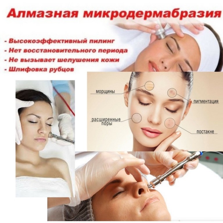 Алмазная шлифовка лица: особенности и принцип действия, показания и противопоказания, этапы и уход за кожей