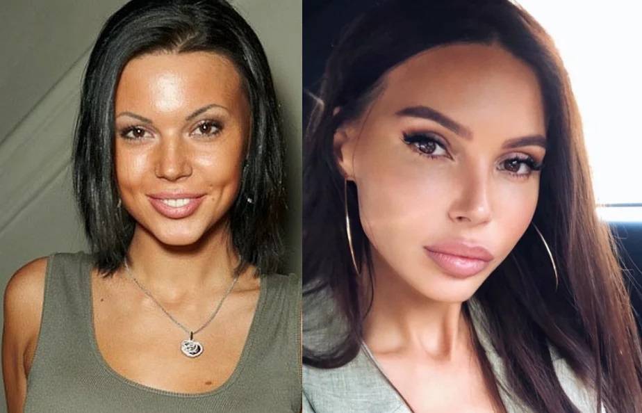 Что оксана самойлова изменила во внешности - фото до и после пластики жены джигана оксаны самойловой