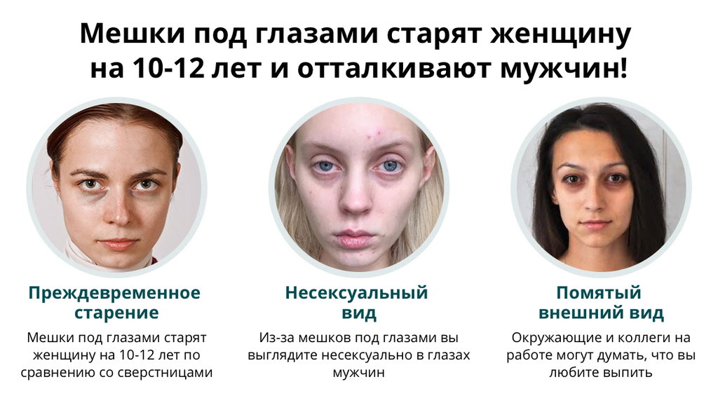 Как убрать синяки под глазами и почему они появляются?