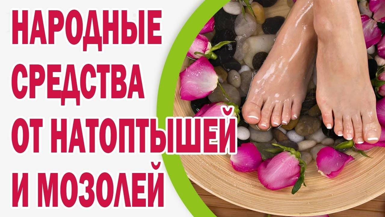 Как лечить мозоль со стержнем в домашних условиях: самые эффективные способы избавления - sammedic.ru