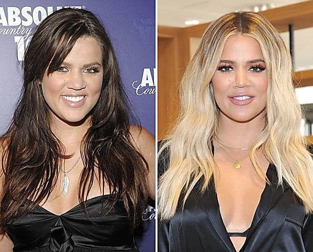 Фигура на миллион: все пластические операции семейства кардашьян | кто?что?где?