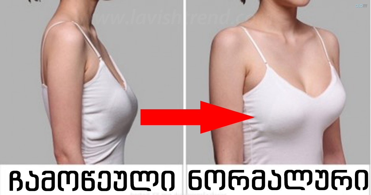 Тубулярная грудь