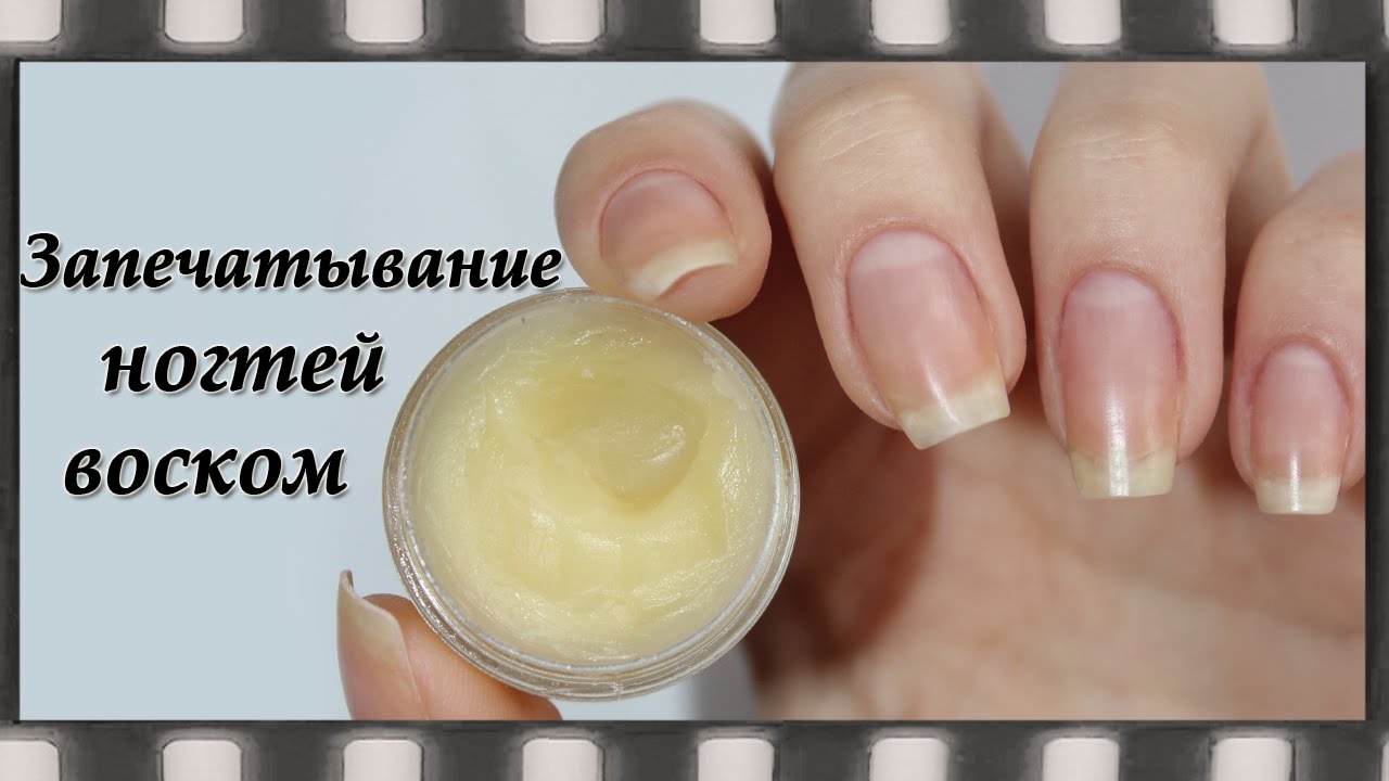 Запечатывание ногтей
