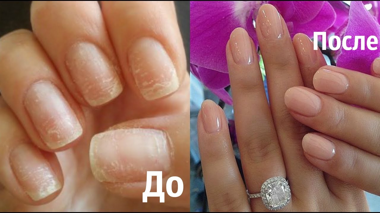Как восстановить ногти после наращивания?!