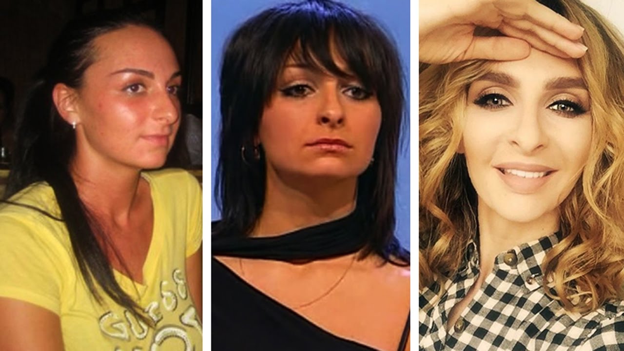 Екатерина варна 30 фото до и после пластики – скачать бесплатно