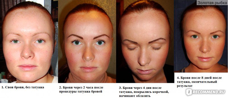 Коросты после перманентного макияжа