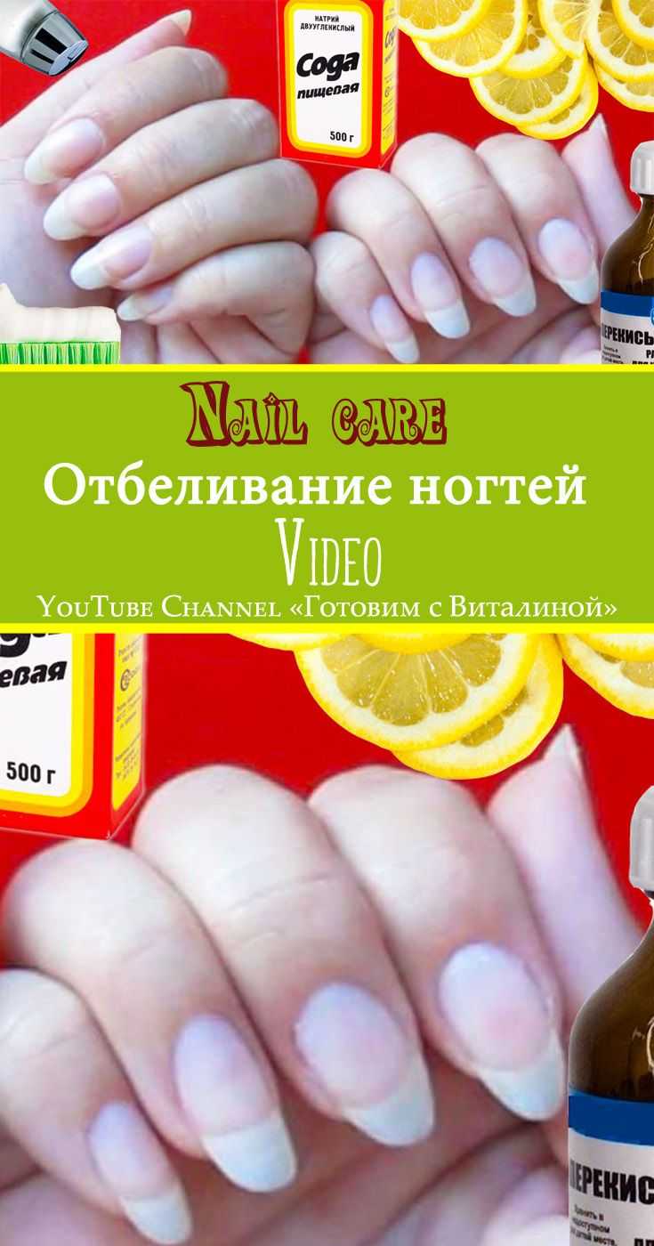 Отбеливание ногтей дома: 9 простых способов