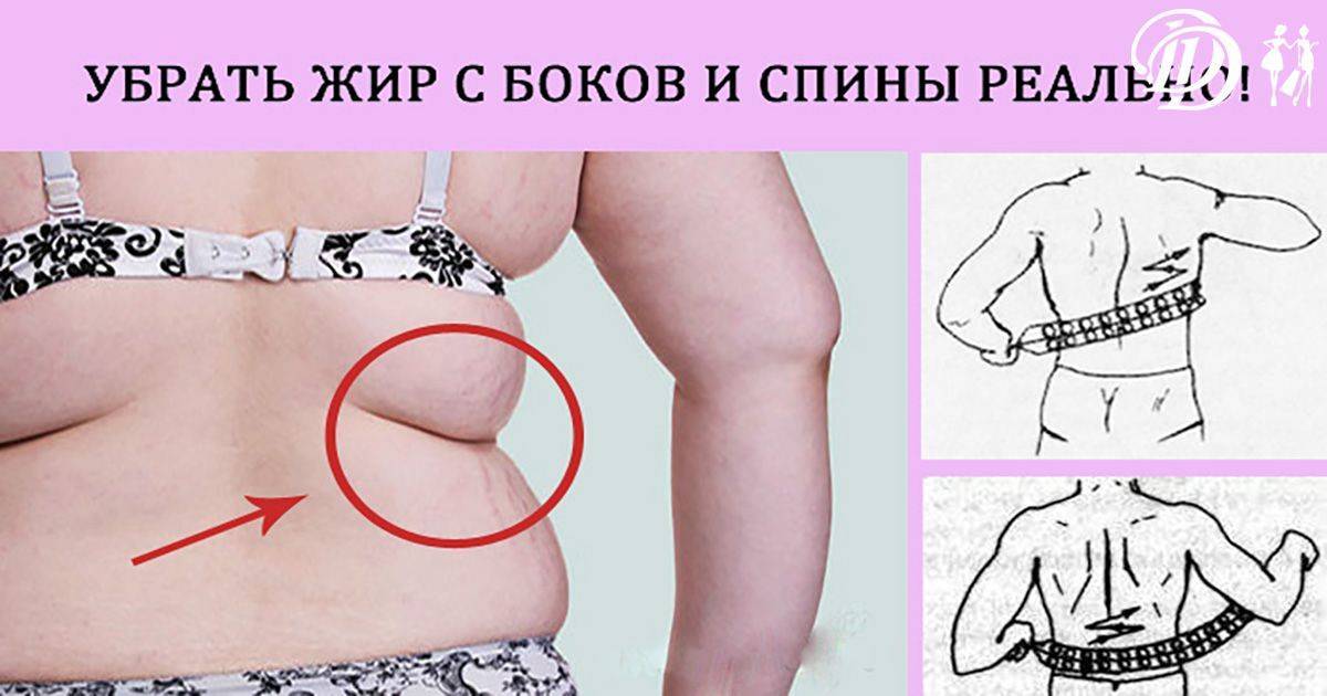 Как убрать складки на спине: в короткие сроки, упражнения в домашних условиях