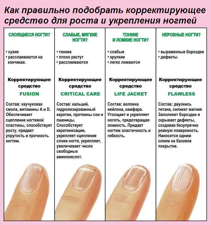 Отслаиваются ногти у основания: необходимы срочные меры! | красивые ногти - дополнение твоего образа