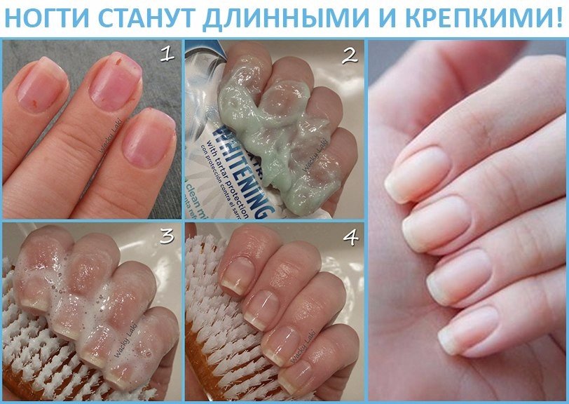 Почему ногти не растут - основные причины