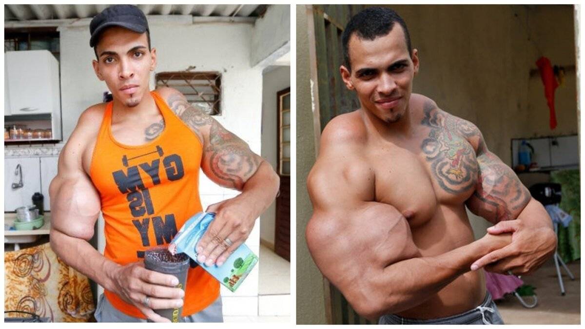 Жертвы синтола: 10 ужасающих примеров