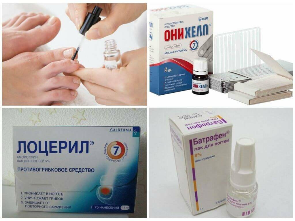 Лучшие таблетки от грибка ногтей на ногах - список эффективных препаратов