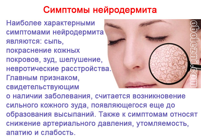 Дерматит - что это такое и от чего бывает: причины, симптомы и лечение хронического кожного заболевания у взрослых - классификация признаков и профилактика болезни кожи