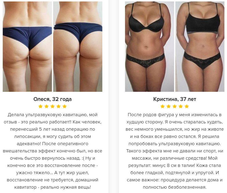 Ультразвуковая кавитация как способ обрести красивую фигуру