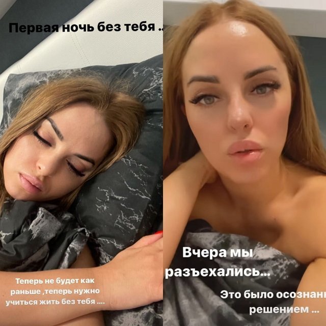 Юлия ефременкова до и после пластики