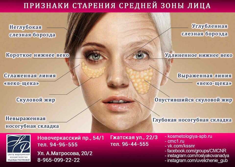Старение кожи лица: причины, как сохранить молодость?