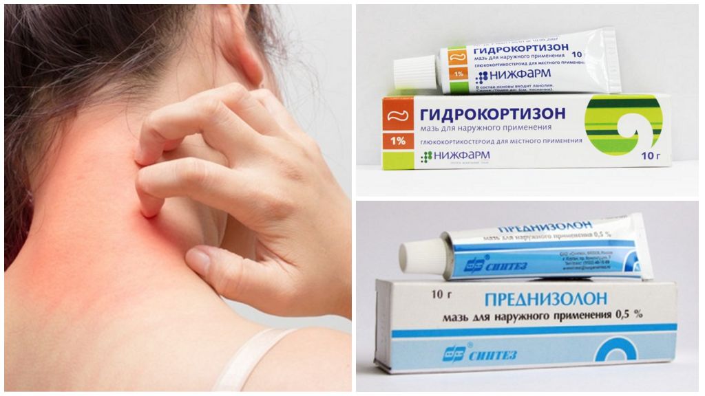 Перечень негормональных мазей от дерматита