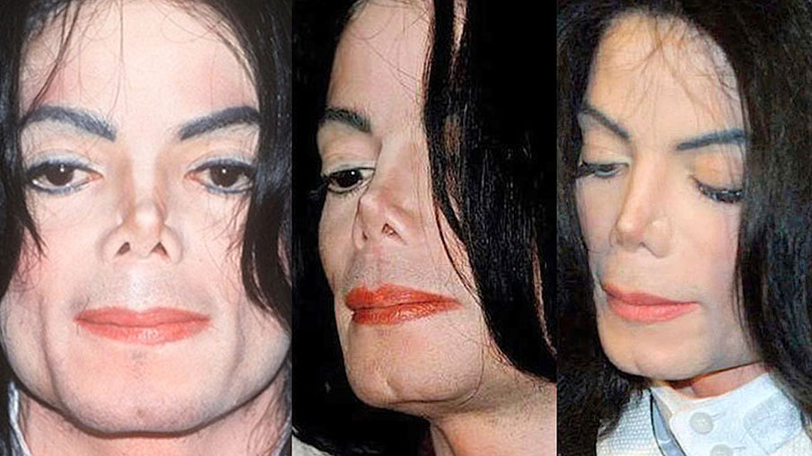 Michael jackson's plastic surgery journey - vanity