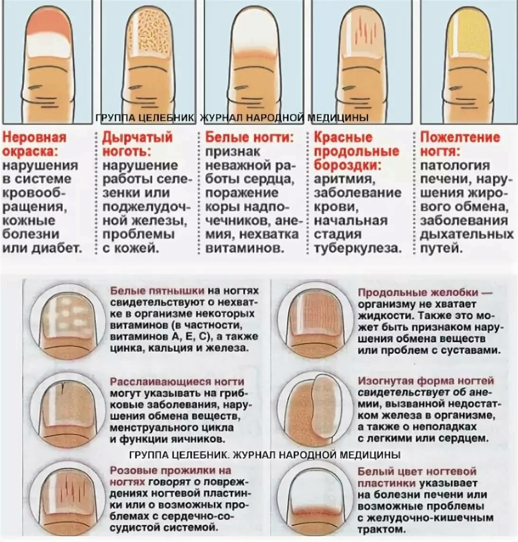 Опасна ли синегнойная палочка для ногтей? как лечить это заболевание?