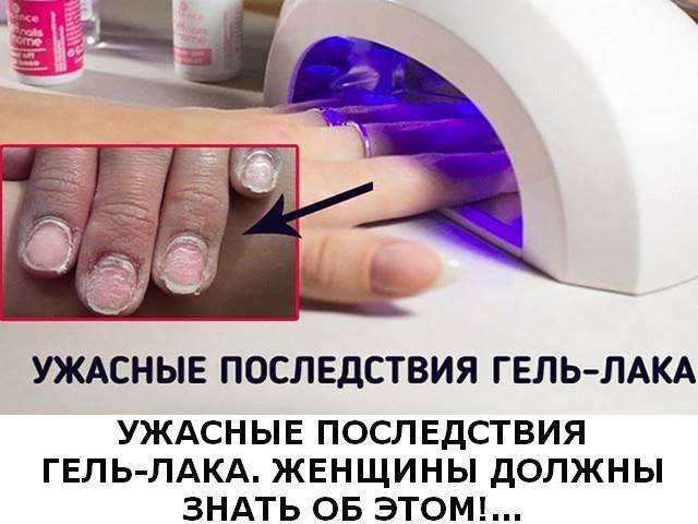 Комплексная защита мастера маникюра от вредных воздействий - уголок красоты "амели"