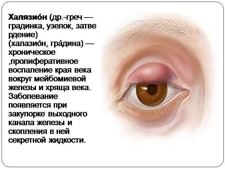 Причины появления мешков под левым глазом. что означают отеки под глазом
