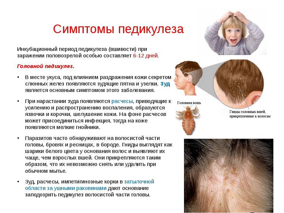 Мази и кремы от лишая